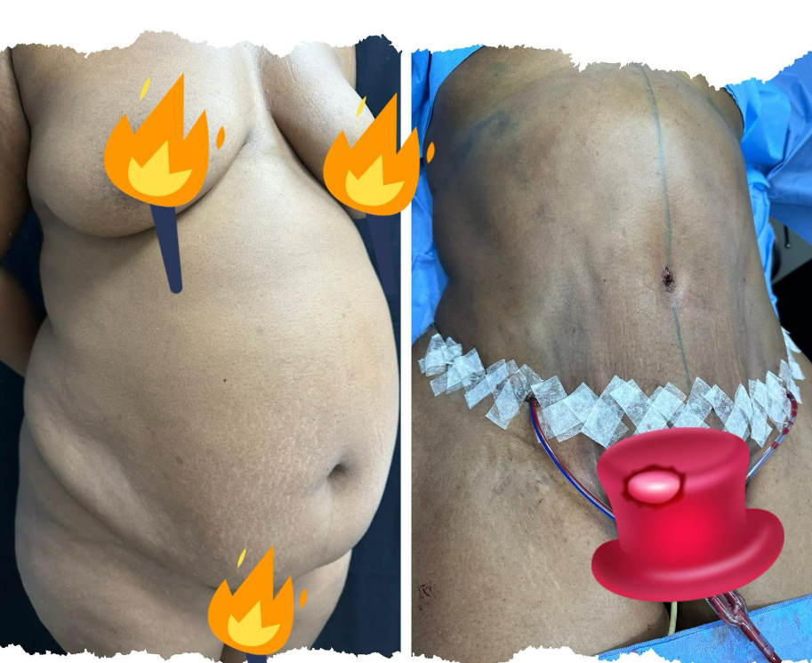 Antes e depois